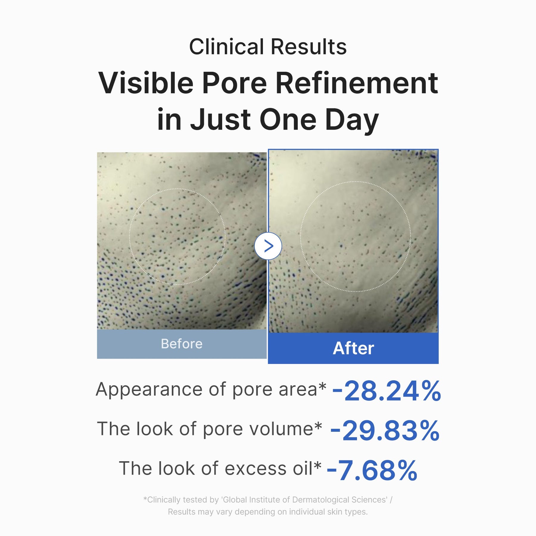 Zero Pore One-day Peptide Serum