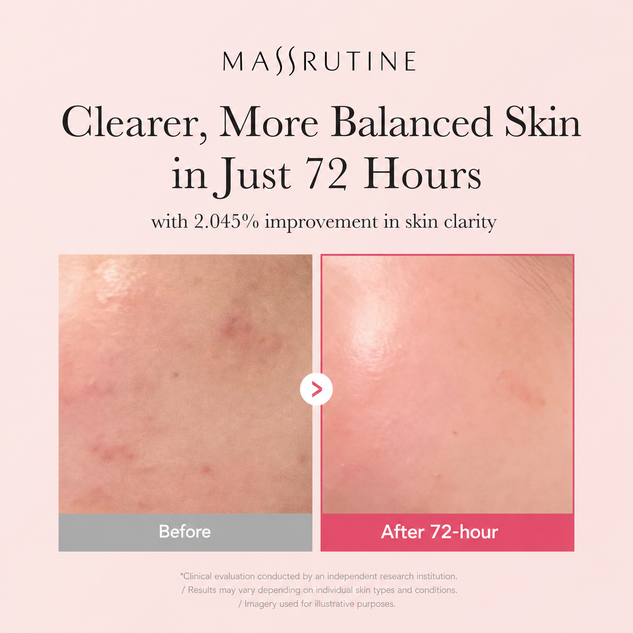 TXA Niacinamide Serum