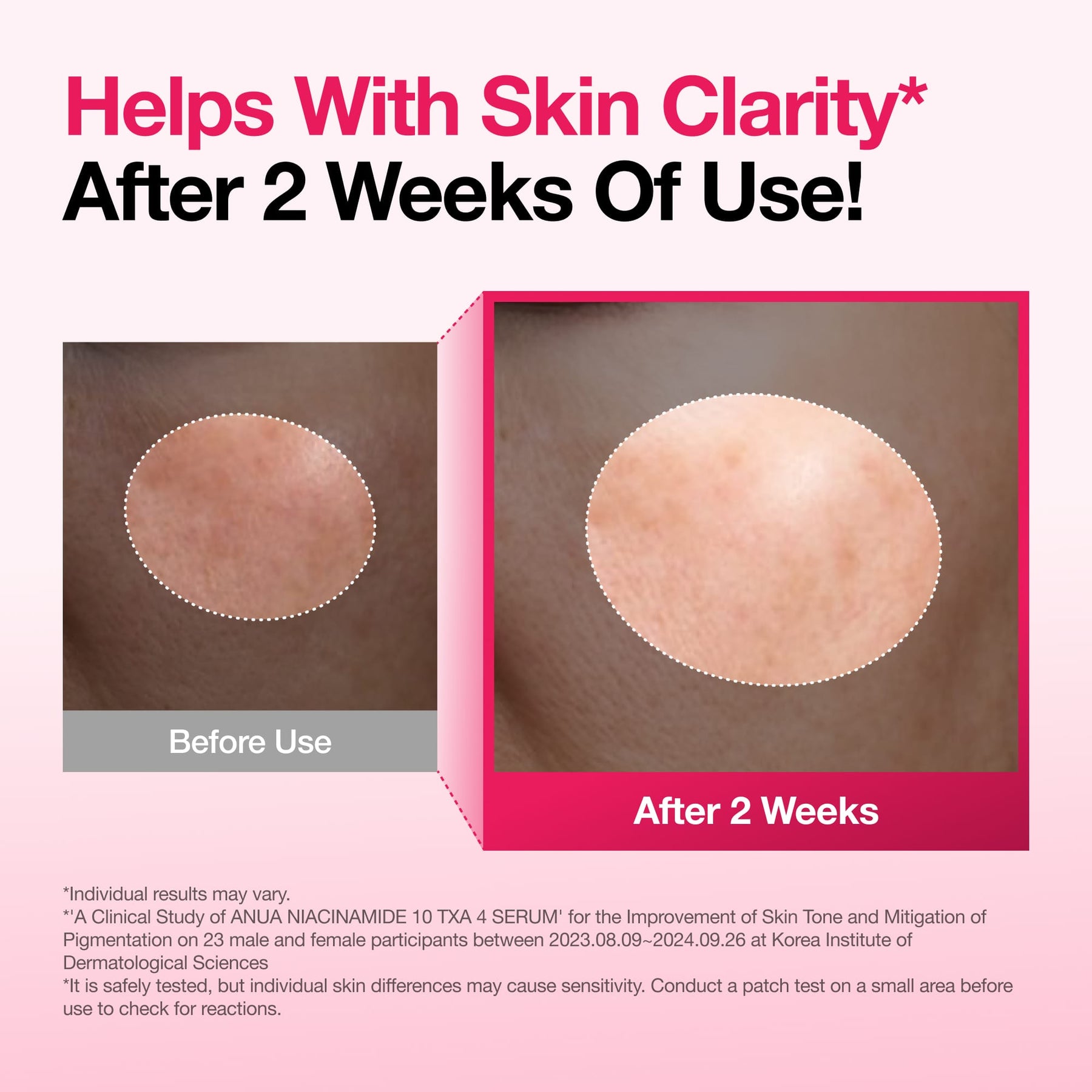Niacinamide 10 TXA 4 Serum